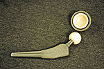 Hip Dysplasia Little Rock AR